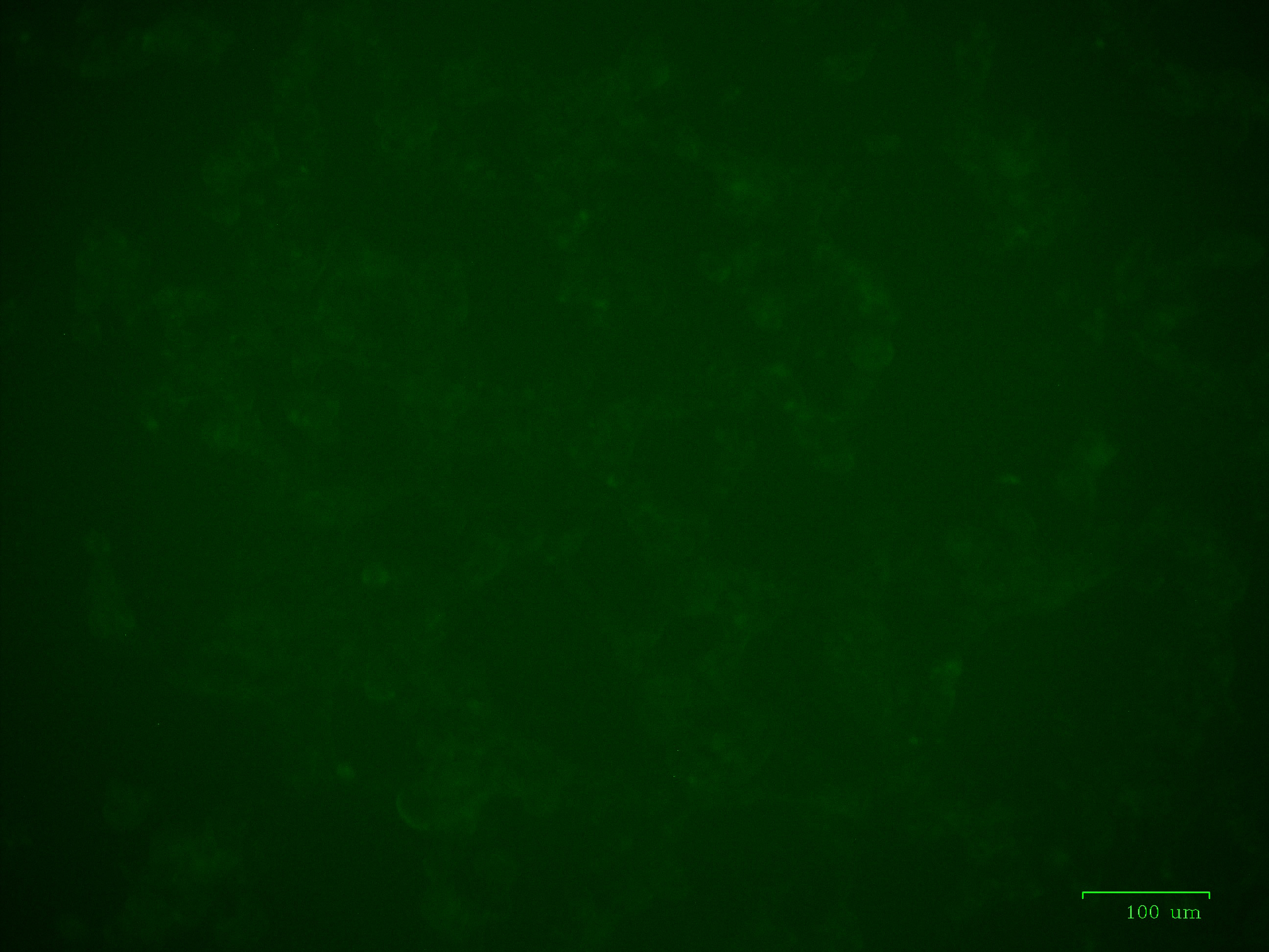 293 cells infected with Cat. No. LV661 Lenti-CMV-DIO-copGFP-SV40-Puro Vector only (i.e. absence of CRE)